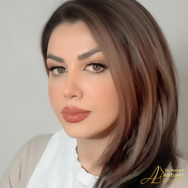 Dr. Abbasi’s Rhinoplasty Portfolio