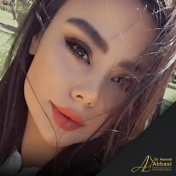 Dr. Abbasi’s Rhinoplasty Portfolio