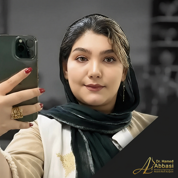 Dr. Abbasi’s Rhinoplasty Portfolio