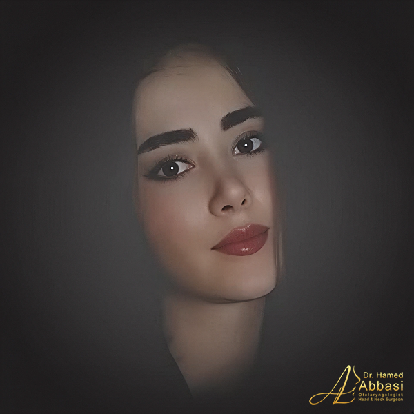 Dr. Abbasi’s Rhinoplasty Portfolio