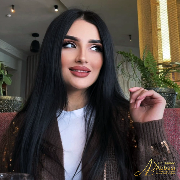 Dr. Abbasi’s Rhinoplasty Portfolio