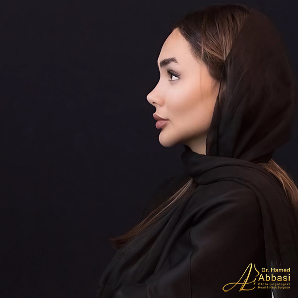 Nose Surgery by Dr. Hamed Abbasi