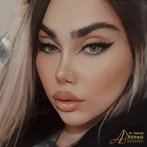 Nose Surgery by Dr. Hamed Abbasi