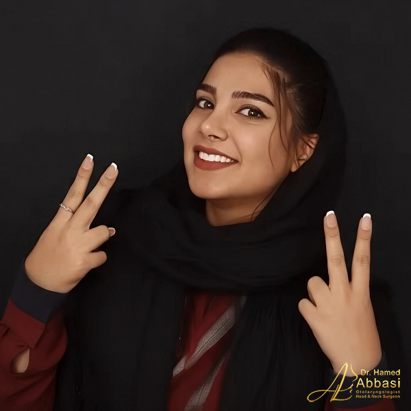 Dr. Abbasi’s Rhinoplasty Portfolio