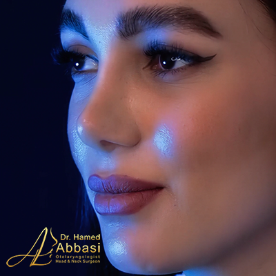 Nose Surgery Photos by Dr. Abbasi